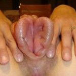 enorme-vulve-gonflee-02 enorme-vulve-gonflee-02