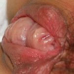 enorme-vulve-gonflee-07 enorme-vulve-gonflee-07