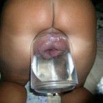 enorme-vulve-gonflee-10 enorme-vulve-gonflee-10