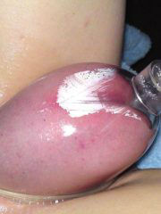 Une pussypump en action avec une grosse chatte gonflée de femme salope